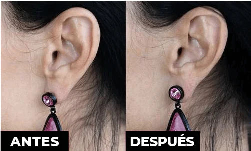 Levantador de Aretes