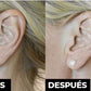 Levantador de Aretes
